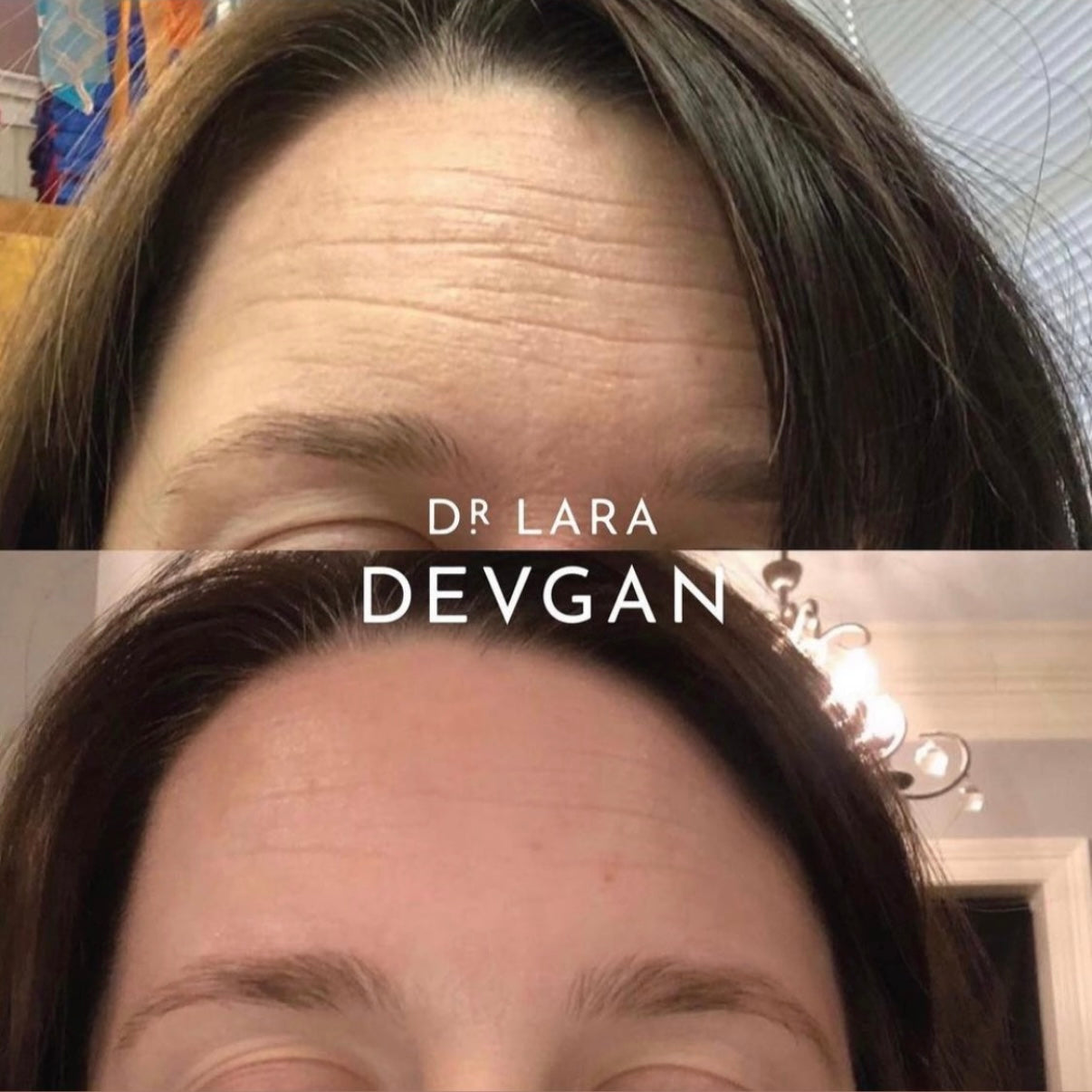 Dr. Devgan Vitamin C+B+E Ferulic Serum