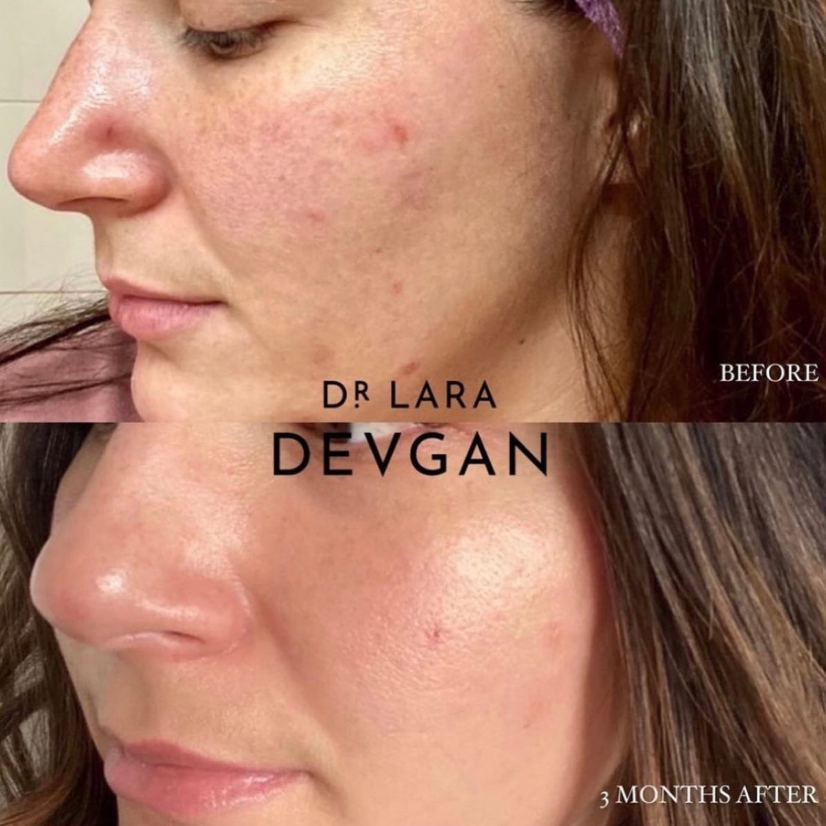 Dr. Devgan Vitamin C+B+E Ferulic Serum