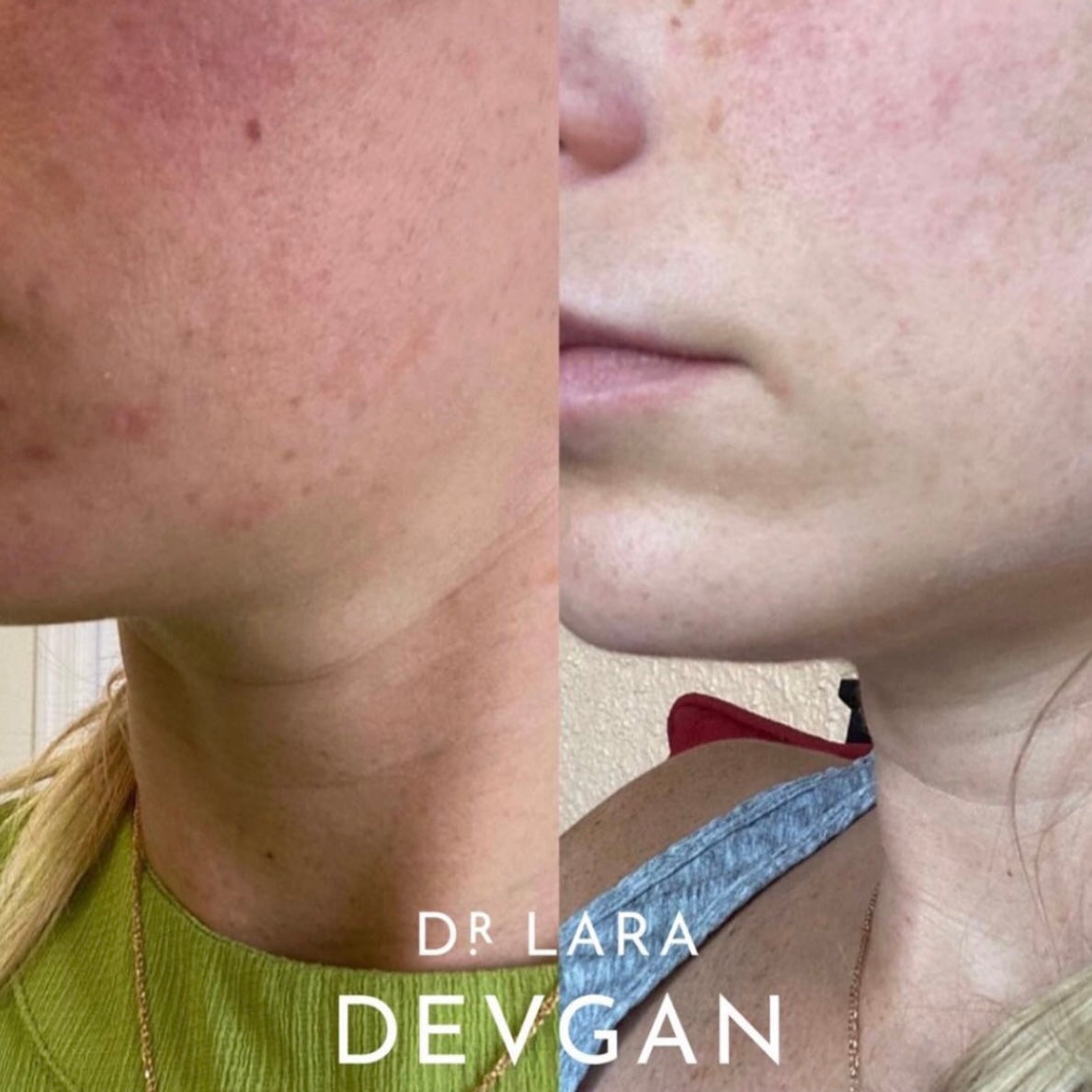 Dr. Devgan Vitamin C+B+E Ferulic Serum