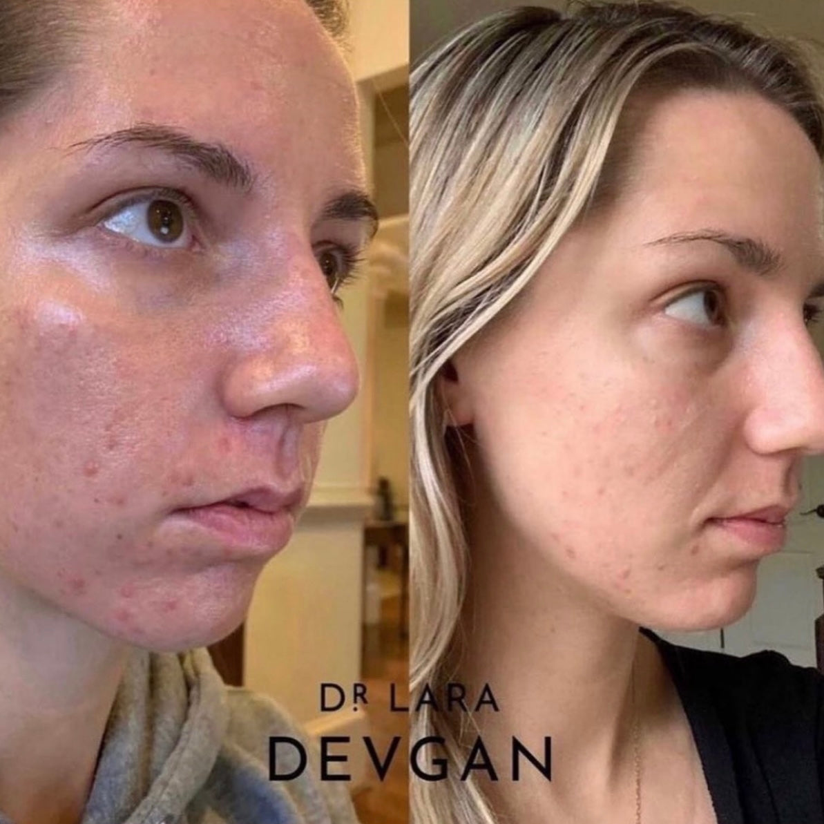 Dr. Devgan Vitamin C+B+E Ferulic Serum