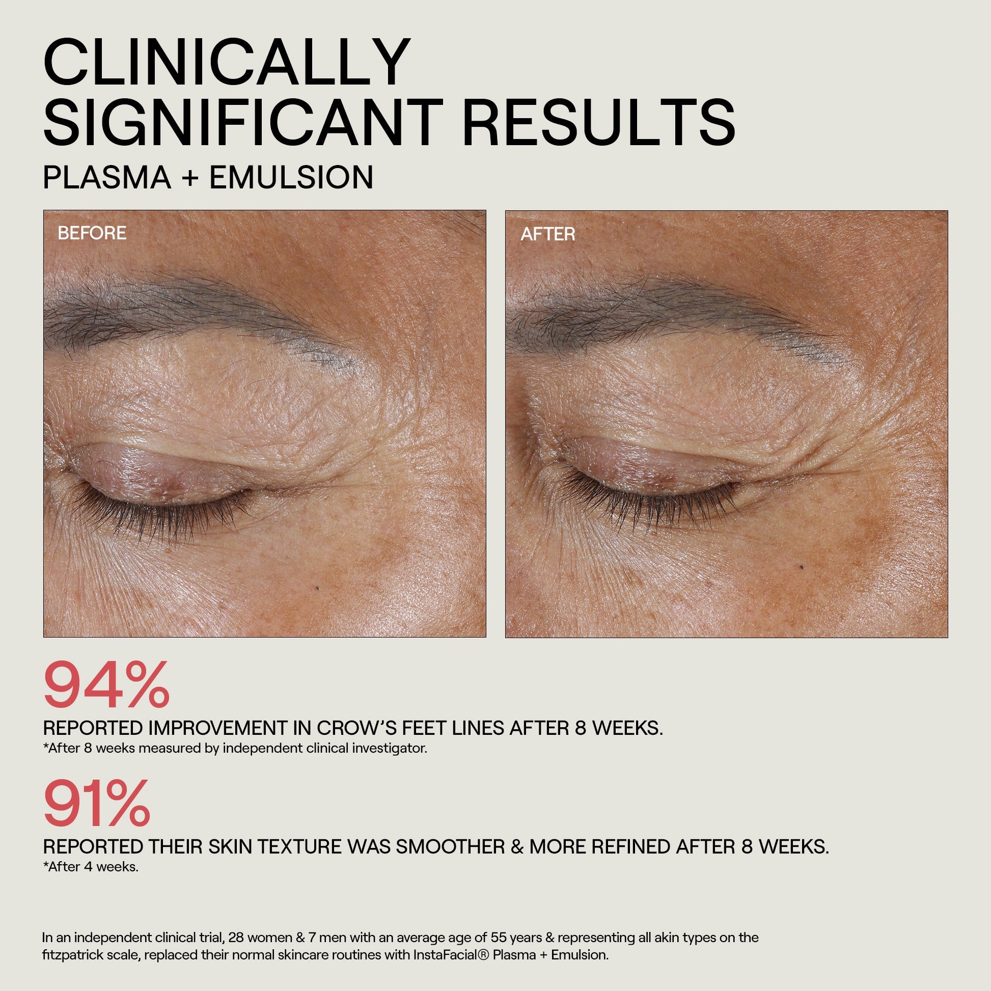 INSTAFACIAL® COLLECTION DISCOVERY SET