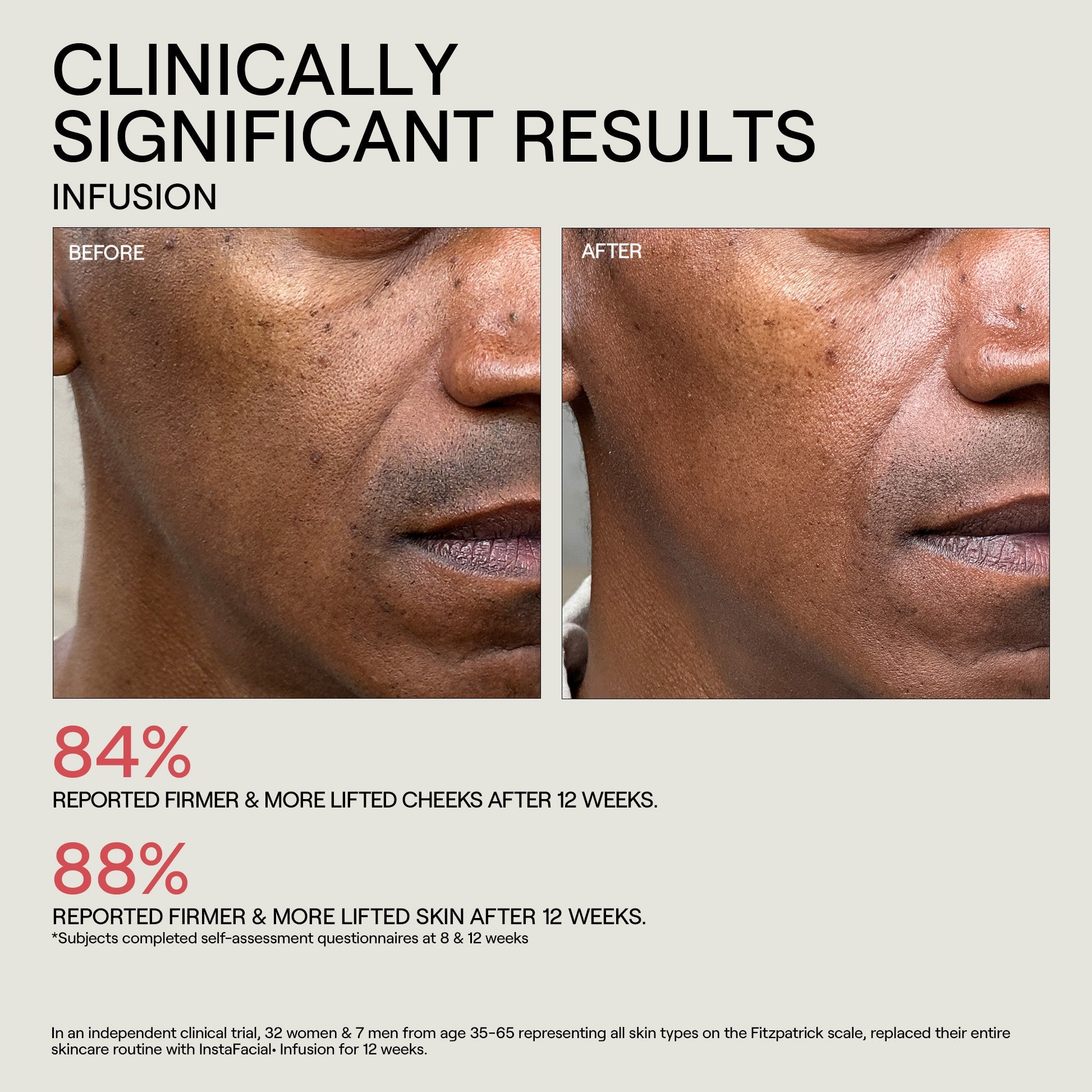 INSTAFACIAL® COLLECTION DISCOVERY SET