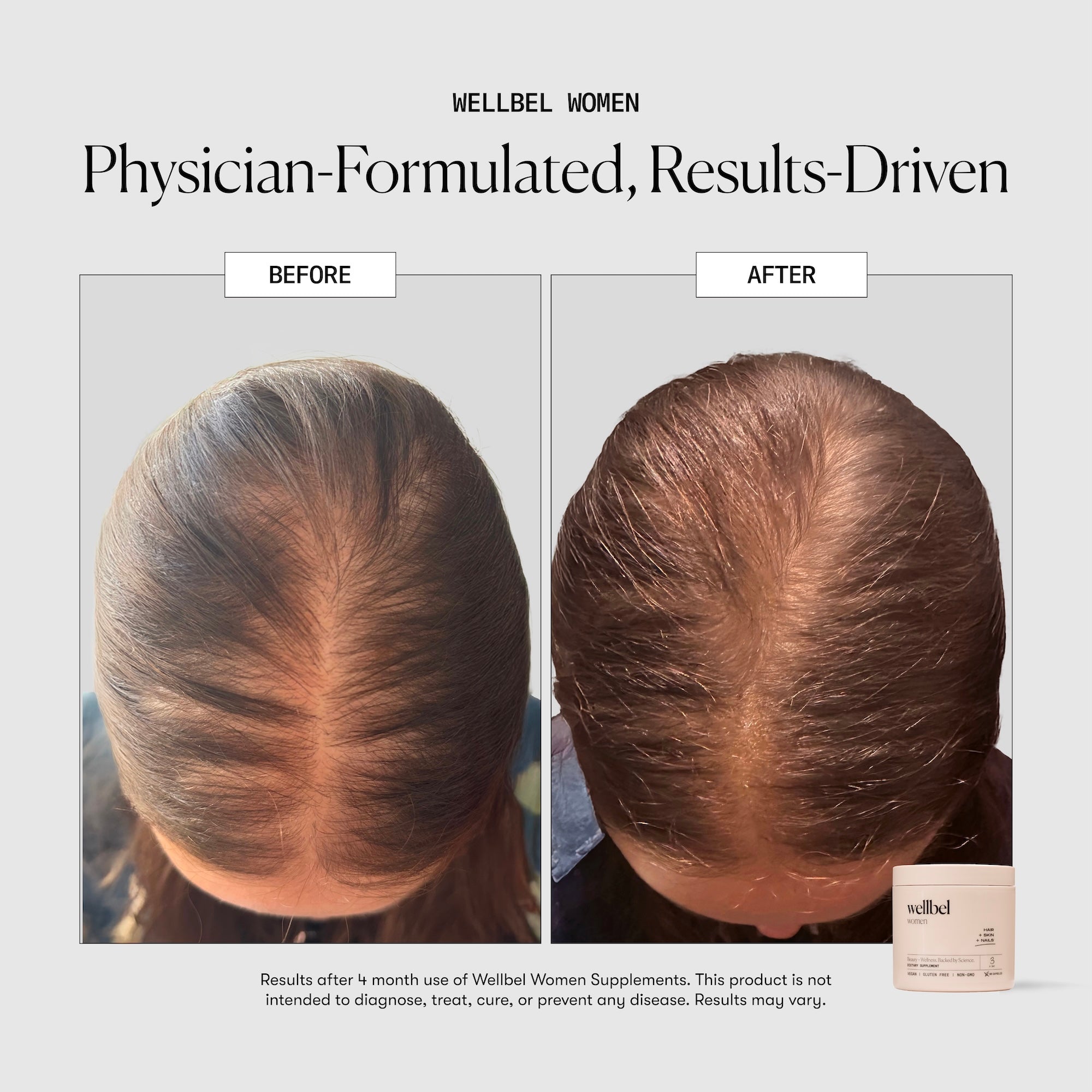 Wellbel Women Single Jar