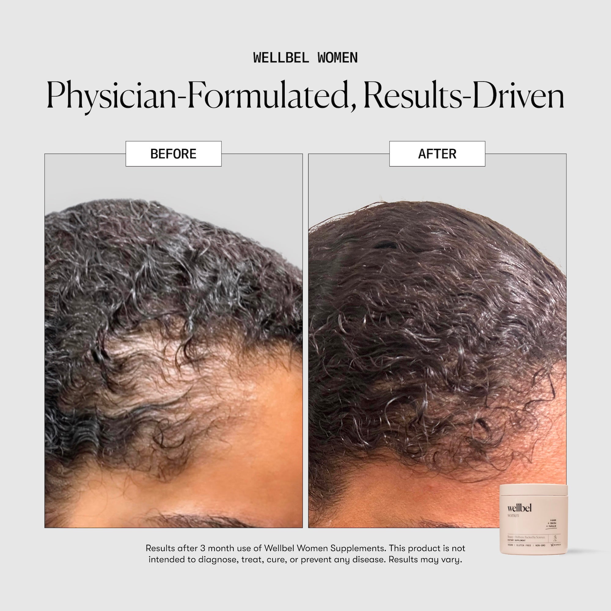 Wellbel Women Single Jar