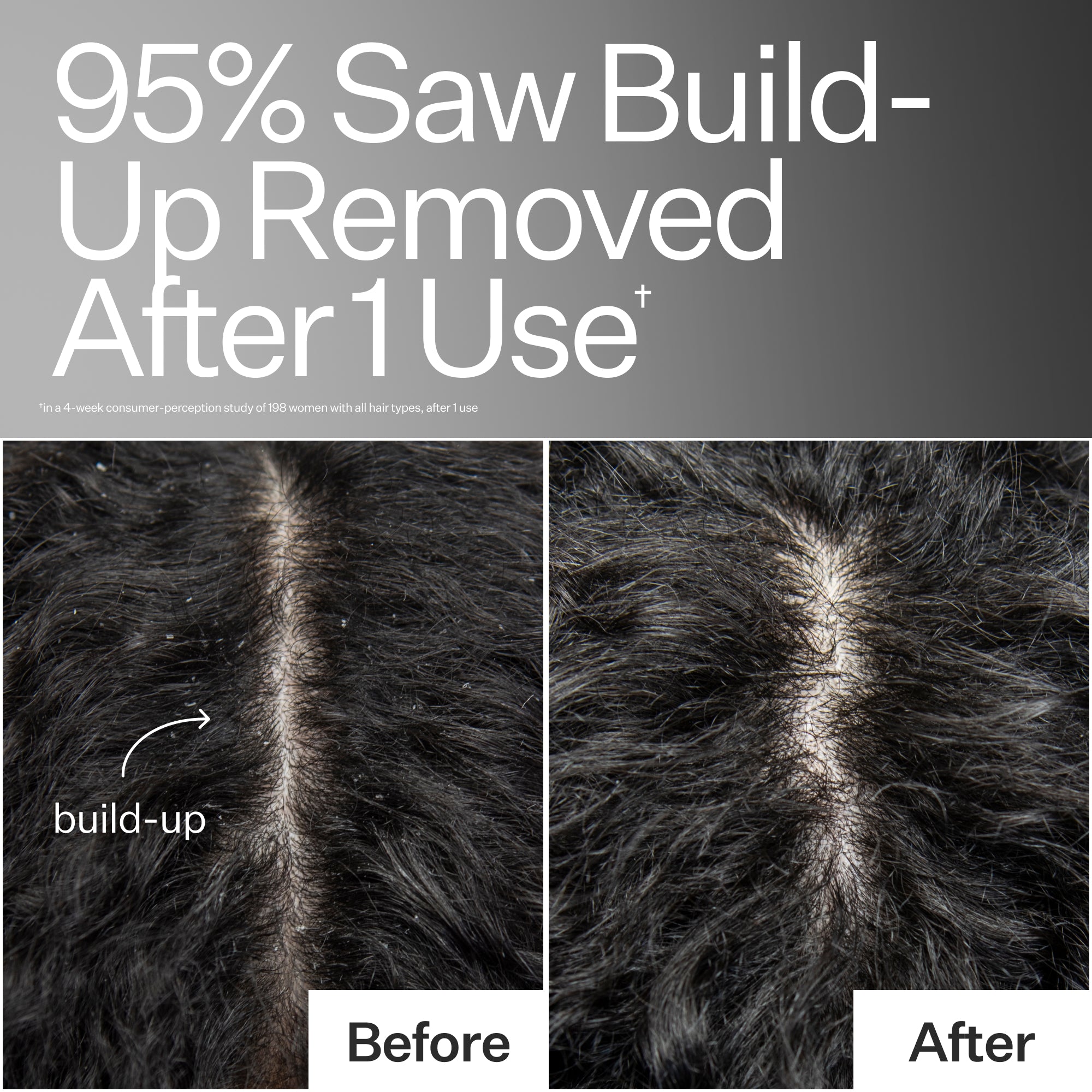 Scalp Detox