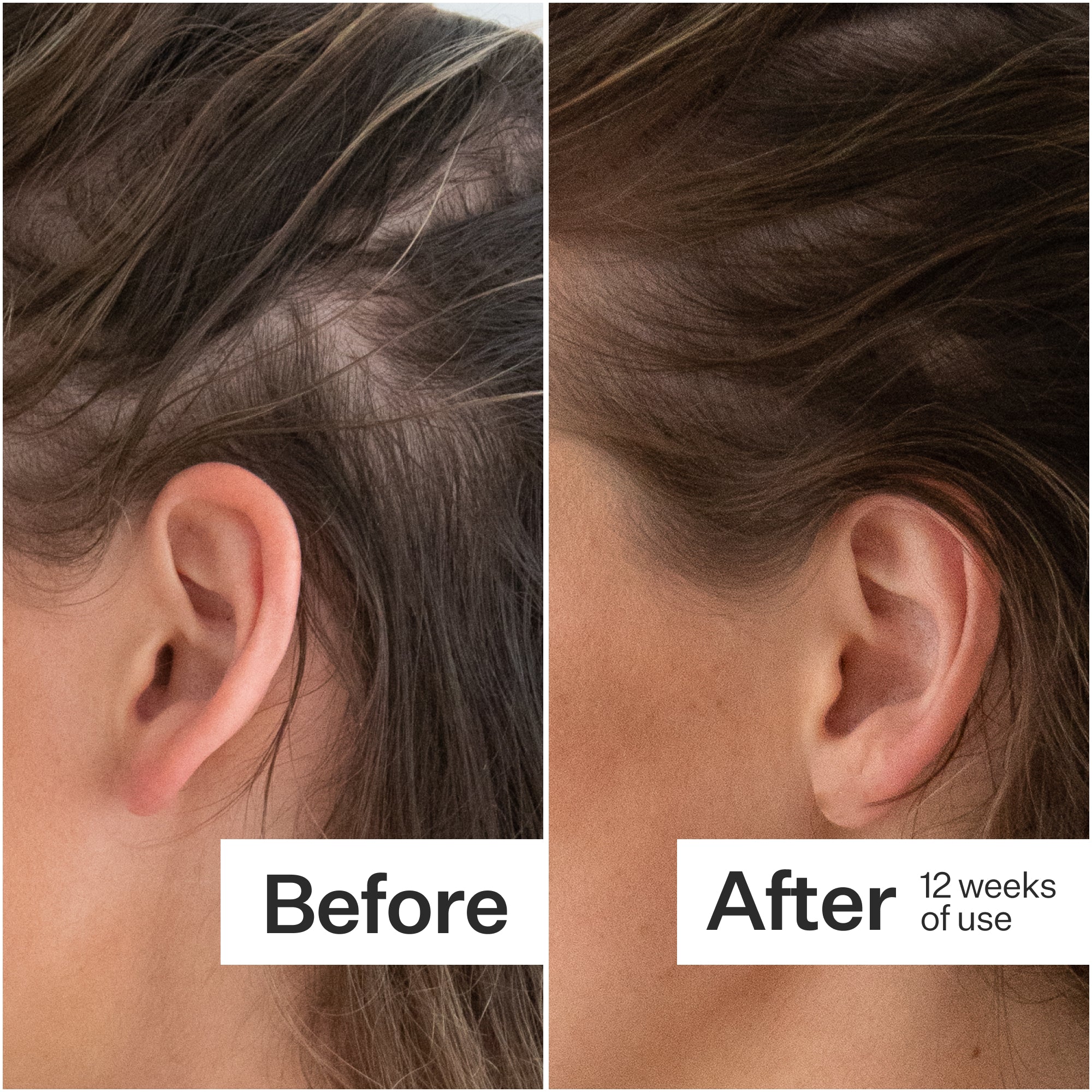Plant Based Hair Capsules