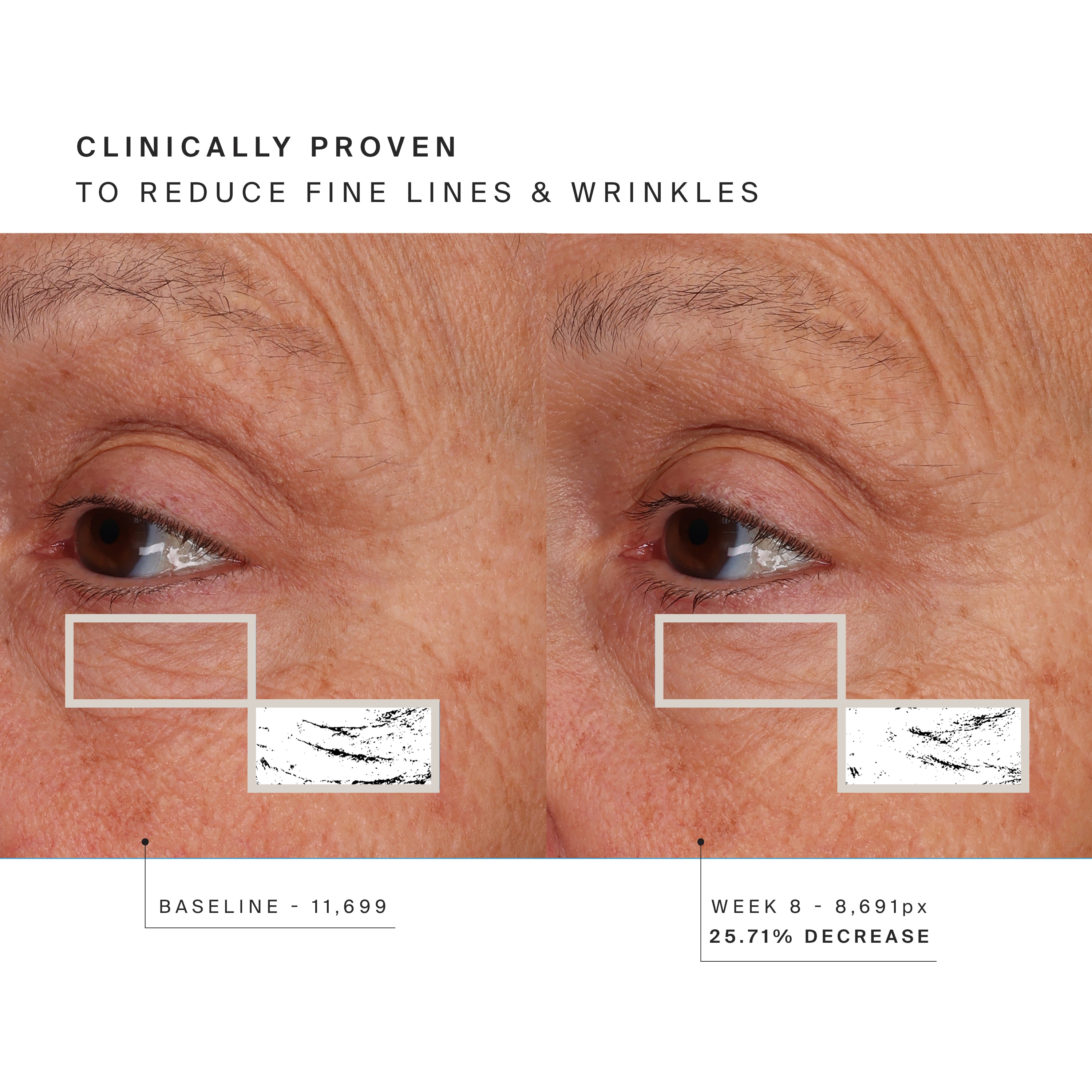 Higherdose Red Light Face Mask