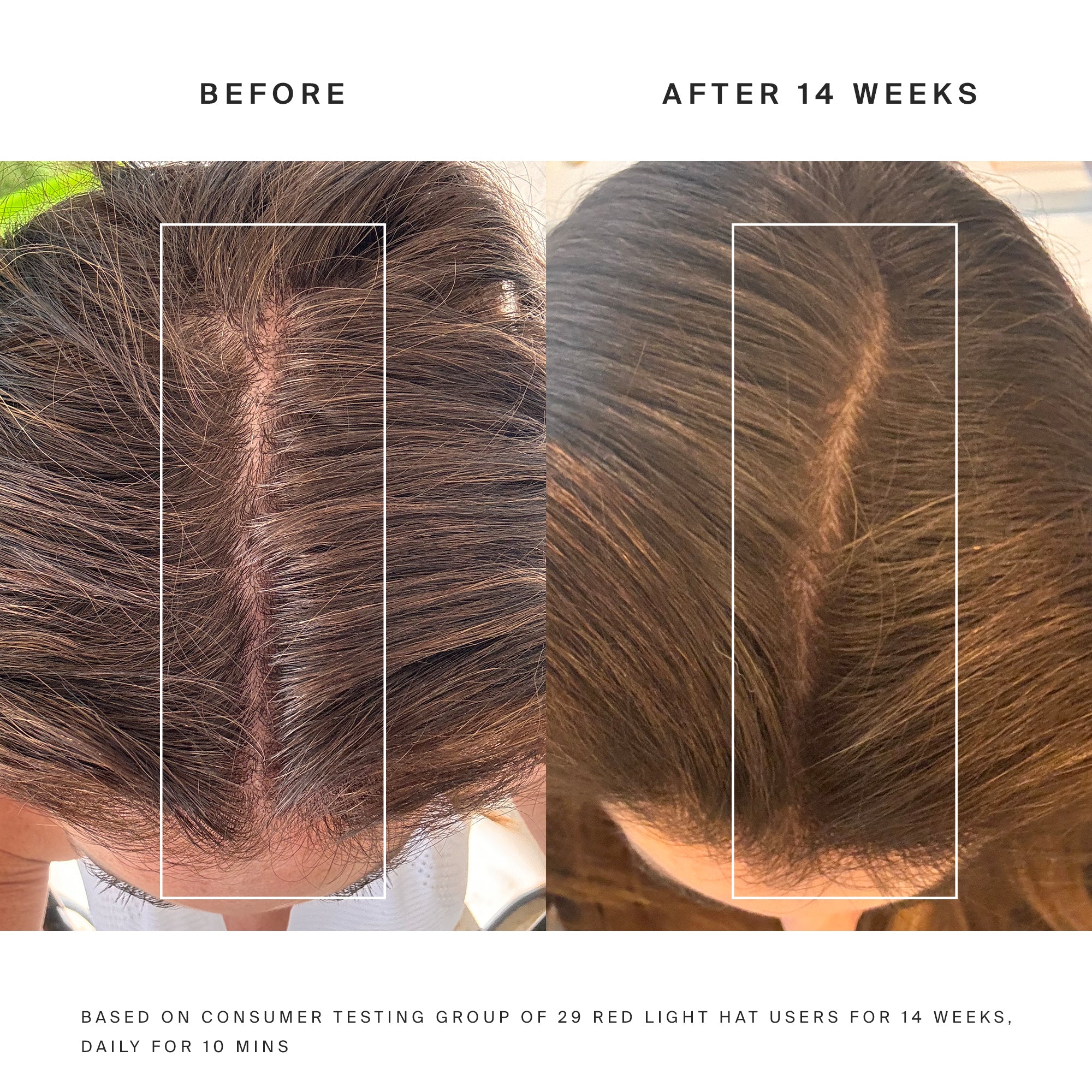 Higherdose Red Light Hat