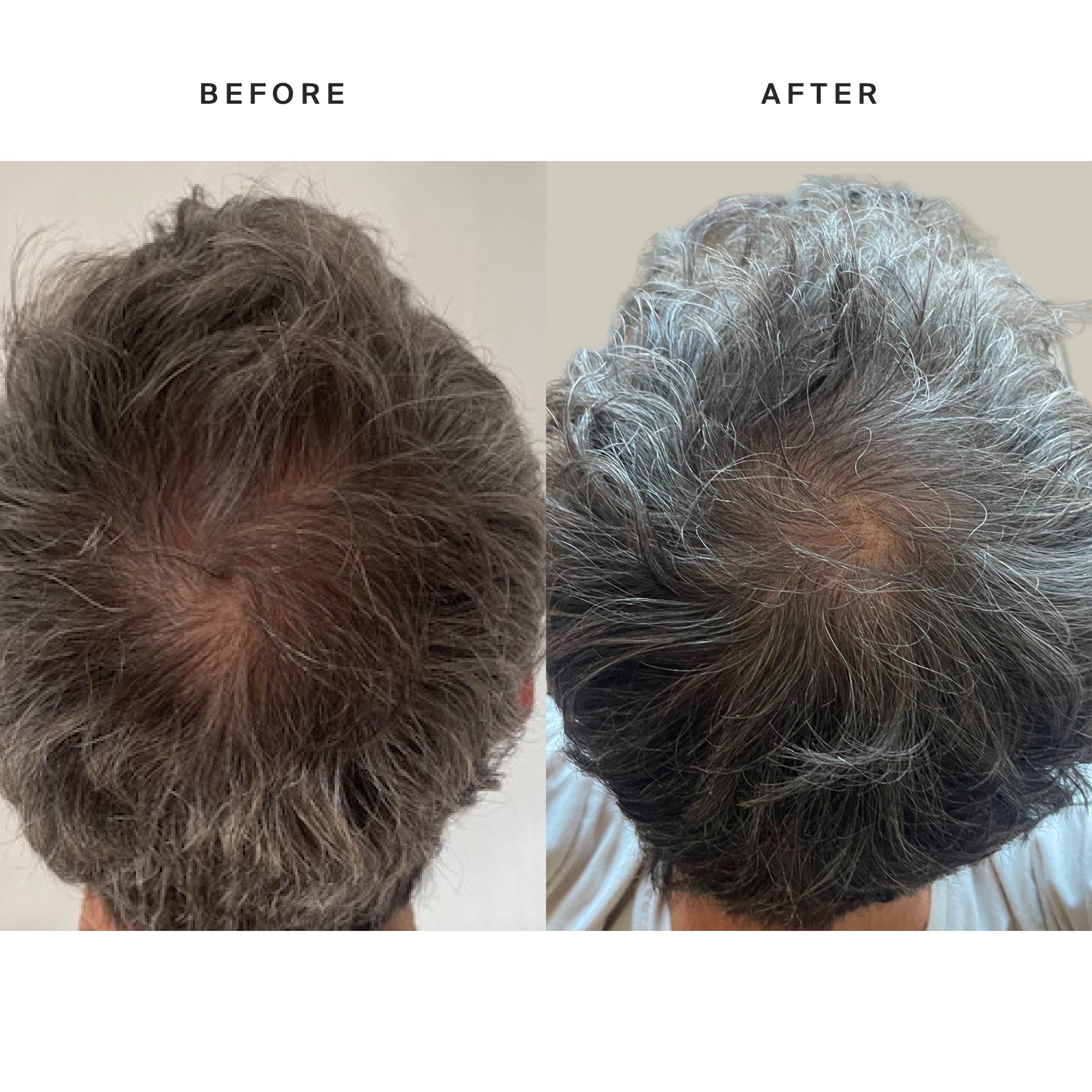 Higherdose Red Light Hat