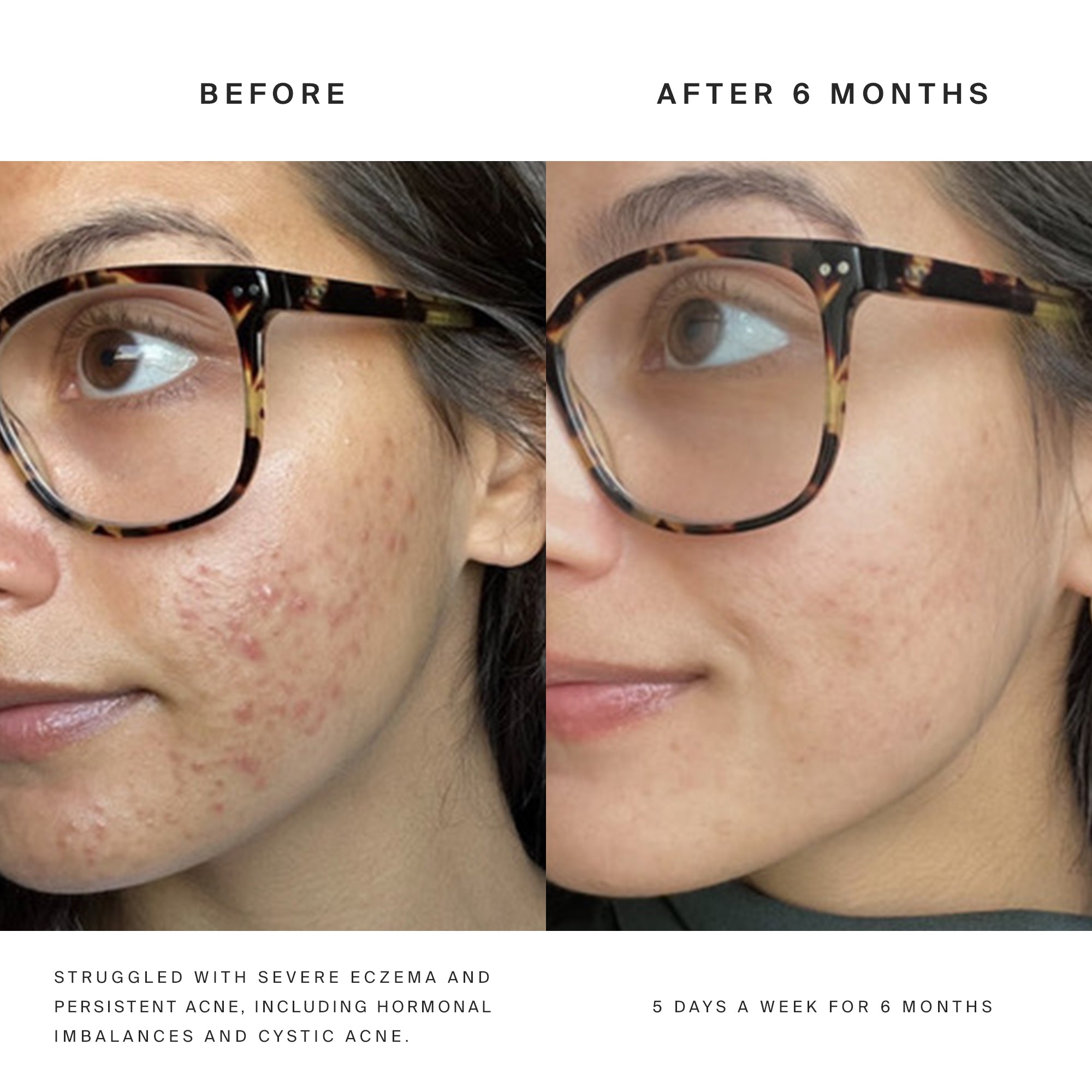 Higherdose Red Light Face Mask – The Shop at Equinox