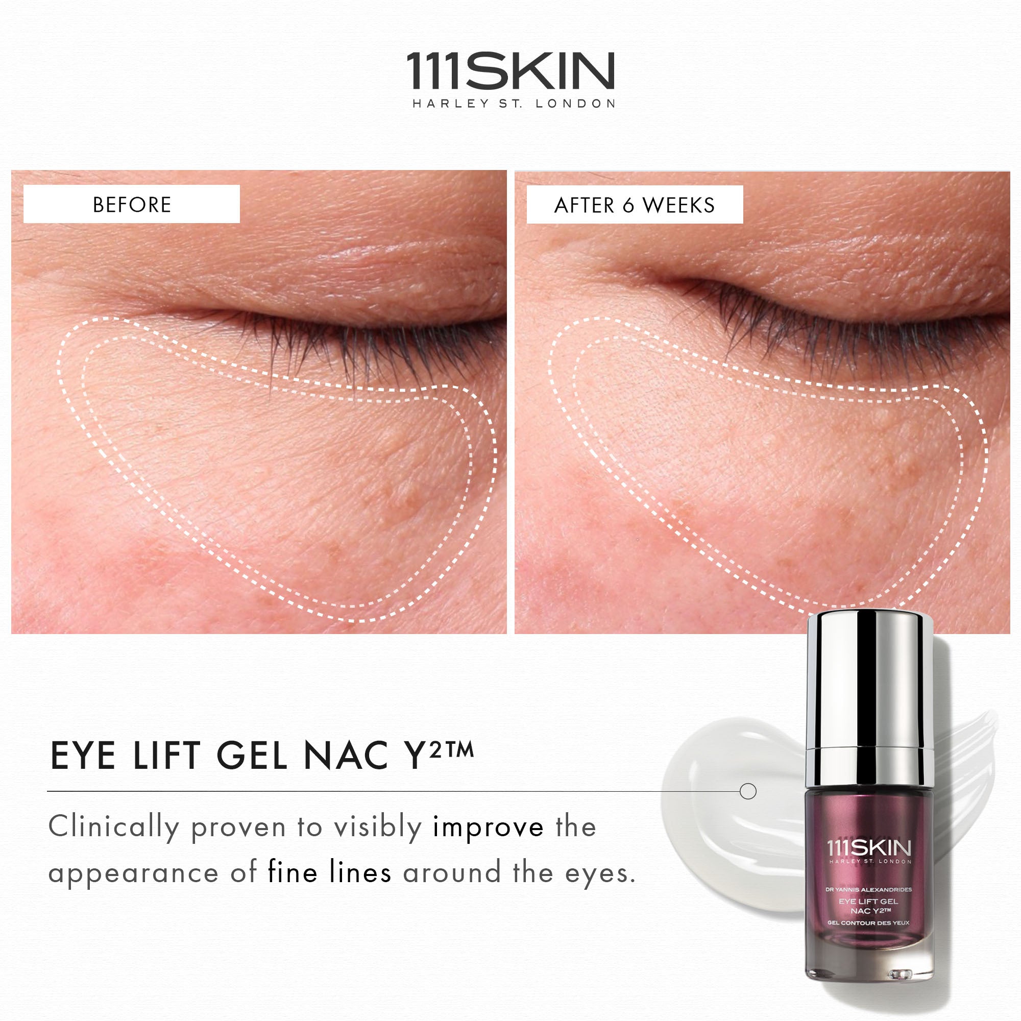 111Skin Eye Lift Gel Nac Y2™