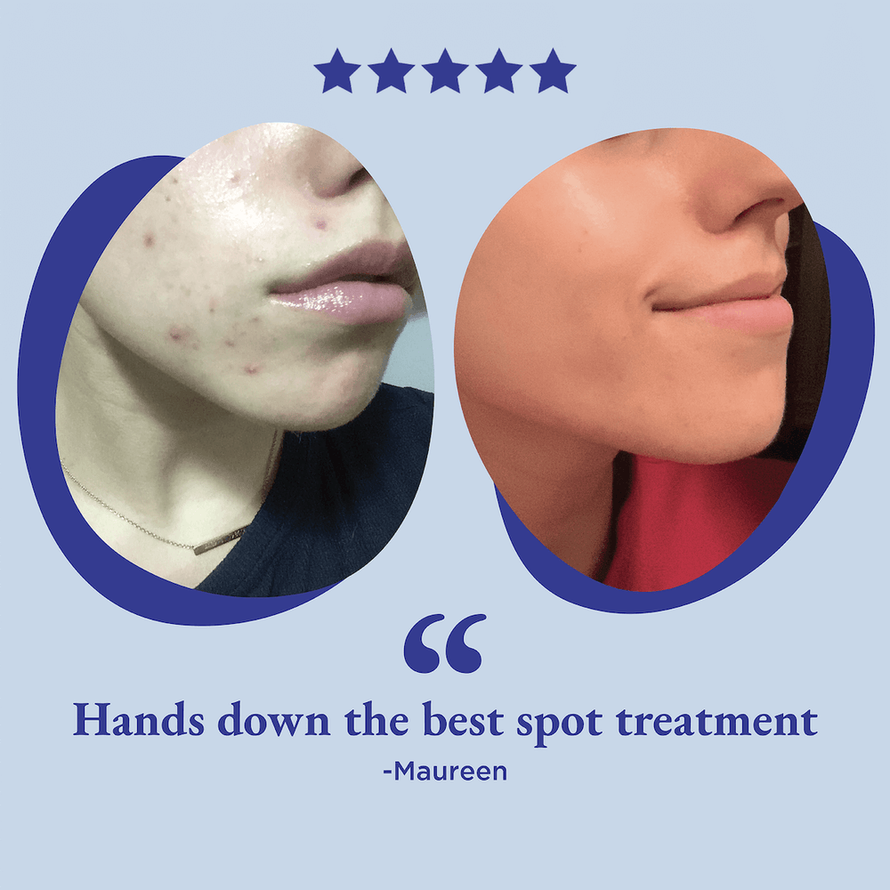 Clear Skin Advanced Spot Concentrate